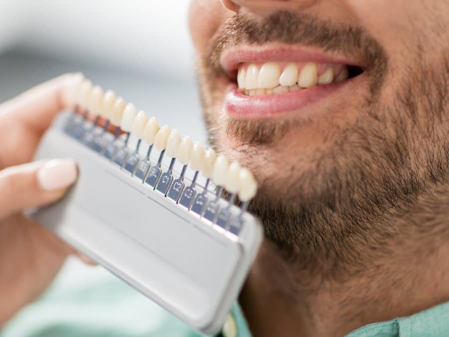 Matching a natural tooth shade during a cosmetic dentistry visit